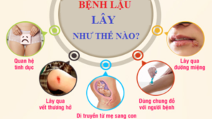 cách phòng tránh bệnh lậu