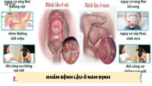 khám bệnh lậu ở nam định
